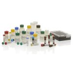 CarrierScan – Expanded Carrier Screening